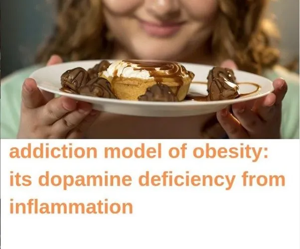 Addiction Model of Obesity: Its Dopamine Deficiency From Inflammation