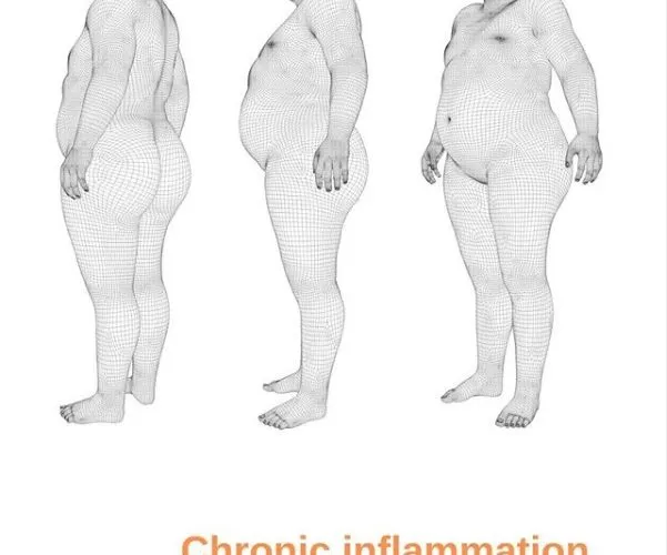 Chronic Inflammation Metabolic Overfeed Hyperinsulinemia