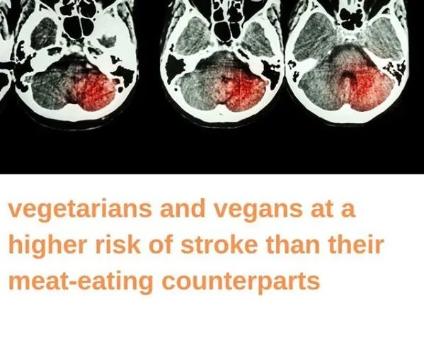 Vegetarians and Vegans May Be at A Higher Risk of Stroke Than Their Meat-Eating Counterparts