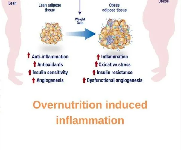 What is Overnutrition Induced Inflammation?