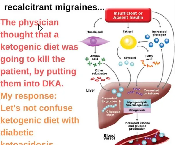 Ketogenic Diet To A T2DM Patient