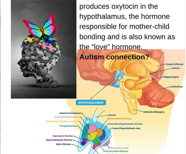 Autism Connection?