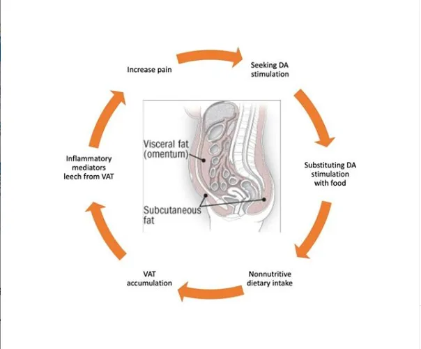 Chronic Pain and Dopamine