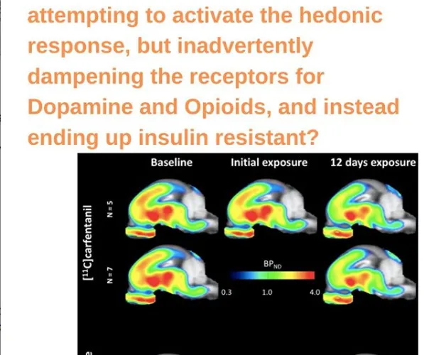 Could Chronic Pain Patients Be Could Substitution Sugar For Opioids….