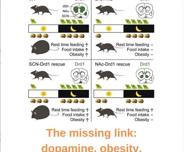 The Missing Link; Dopamine, Obesity, Metainflammation, Diabetes Type 2