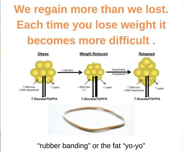 Rubber Banding” or The Fat “Yo-Yo” or Relapse-Induced Hyperplasia of Adipose Tissue