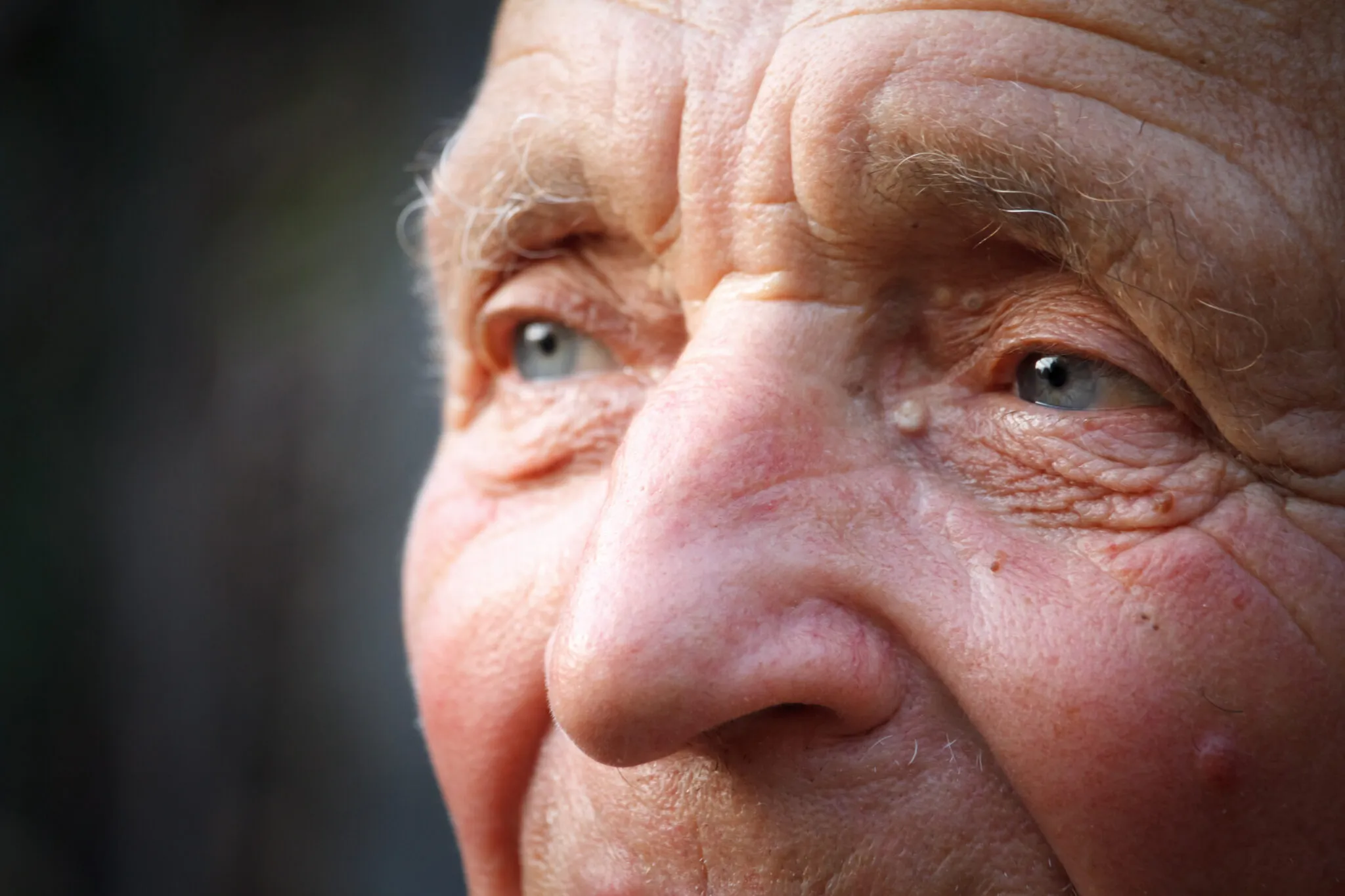 Financial insecurity and risk of dementia